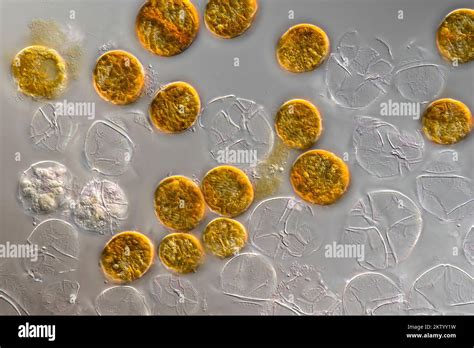  Peridinium! En mikroskopisk alg med en kraftfull svängning